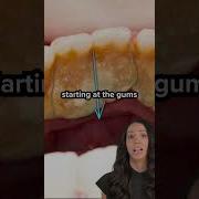Teeth
