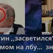 Бюн Путин Засветился Со Шрамом На Лбу