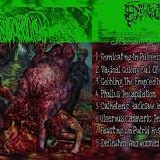 Epicardiectomy Full Album