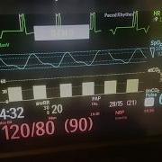 Philips Demo Mx400