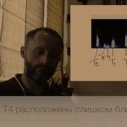 Ритмы Галопа 4