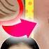 Magic Shiatsu Massage Intense Exercises To Tighten Droopy Eyelids In 7 Days