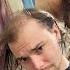 I HAD Perfect Hair BALDING Head Shave TRANSFORMATION
