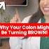 Melanosis Coli When Your Colon Mysteriously Turns Brown