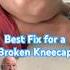 How To Fix A Broken Kneecap Shorts