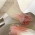 ACL Reconstruction Using Your Own Tendon 3D Animation