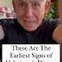 These Are The Earliest Signs Of Alzheimer S Disease