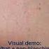 Do You Know What A Non Blanching Rash Looks Like Rash Shorts Emergency Parentlife Hack Tips