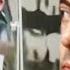 Mr Dentist Bean Mr Bean Funny Clips Mr Bean Official
