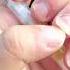 Watch This Nail Biter Grow Nails Again Thanks To Exsivia