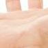 1 Master Point Relieves Insomnia Stress And Anxiety Drmandell Stress Anxiety Insomnia