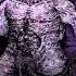 Epicardiectomy Deranged Self Mutilating Emasculation 2013 Full Demo