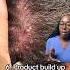 10 Causes Of ITCHY Scalp