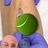 Best Fix For Lateral Elbow Pain