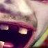 GIVE ME A HUG Dropsy