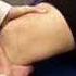 Knee Exam Lachman Test