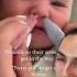 Baby Sinus Hacks Sinus Nose Allergies