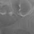 Retrospective View Of A Hysterosalpingogram HSG Procedure Konica Minolta Healthcare