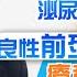 泌尿健康學堂 第四集 良性前列腺增生 療程的喜與悲 HKUA 香港泌尿外科學會