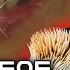 해외레전드 매일 이쑤시개 1500개 生으로 씹어 먹는 여인 About 1 500 Toothpicks A Day Her Weird Diet For 10 Years