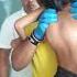 Scoliosis Treatment By Indian Chiropractor Dr Rajneesh Kant
