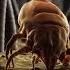 Scalp Infested With Head Lice