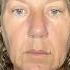 Face Transformation Face Fitness Face Yoga Face Massage