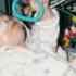 My Son Joe Tetrasomy 8p Mosaic Down Syndrome Part 1 Disabled Medical Life