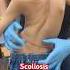Chiropractor Scoliosistreatment Rkm Drrajneeshkant