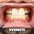 Tooth Shape Meaning