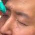 DAXXIFY WITH DR YOUN Injection Shorts Viral Trending