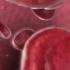 Explaining Anemia