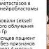 Опыт стереотаксического облучения рецидива нейробластомы с поражением головного мозга Гиршович М М
