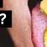 Allergists Debunk 11 Food Allergy Myths Debunked