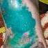 My Daughter Foot After Holiday
