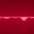 French Fuse Target Fuse