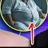 CIRUGÍAS BARIATRICAS Estas Son Las CONSECUENCIAS Segun ESPECIALISTA Diagnóstico 82 Mr Doctor