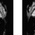 NOVA NOVA Short Inside Oliver Sacks S Brain