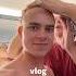 NICK WILKINS IS BALD