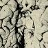 A Scientist Spilled 2 Drops Organic Mercury On Her Hand This Is What Happened To Her Brain