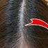 How Ashwagandha Helps To Regrow Thick Hair Stop Shedding Stop Hair Fall Hair Growth
