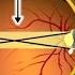 How The Eye Works Animation How Do We See Video Nearsighted Farsighted Human Eye Anatomy