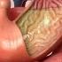 Aspirin Journey Through The Body 3D Animation
