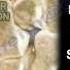 Guyon S Canal Ulnar Tunnel Syndrome Everything You Need To Know Dr Nabil Ebraheim