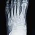 Can You See The Fracture