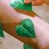 Boy Born With Leaves On His Legs But Discovers It S A Gift