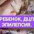 РЕБЕНОК ДЦП ЭПИЛЕПСИЯ Сибирское здоровье