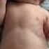 What Does RSV Look And Sound Like In Babies And Kids