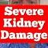 These Common Pills Damage Your Kidneys