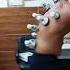 When There Is Stiffness Do Cupping Loosen Up Your Muscles Just Relax Chiro Physiocity Cupping